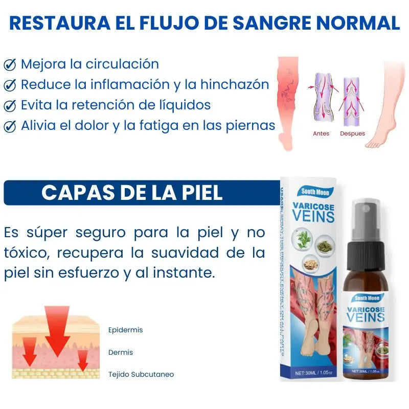 VeinErase™ | Elimina Venas Varices