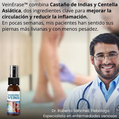 VeinErase™ | Elimina Venas Varices